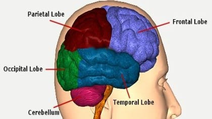 Early Onset Dementia: A Devastating Form of Alzheimer's