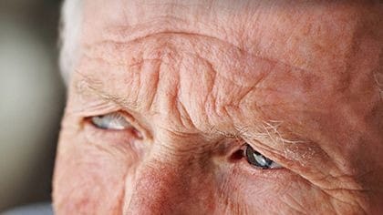 What Are the Signs and Symptoms of Dementia?