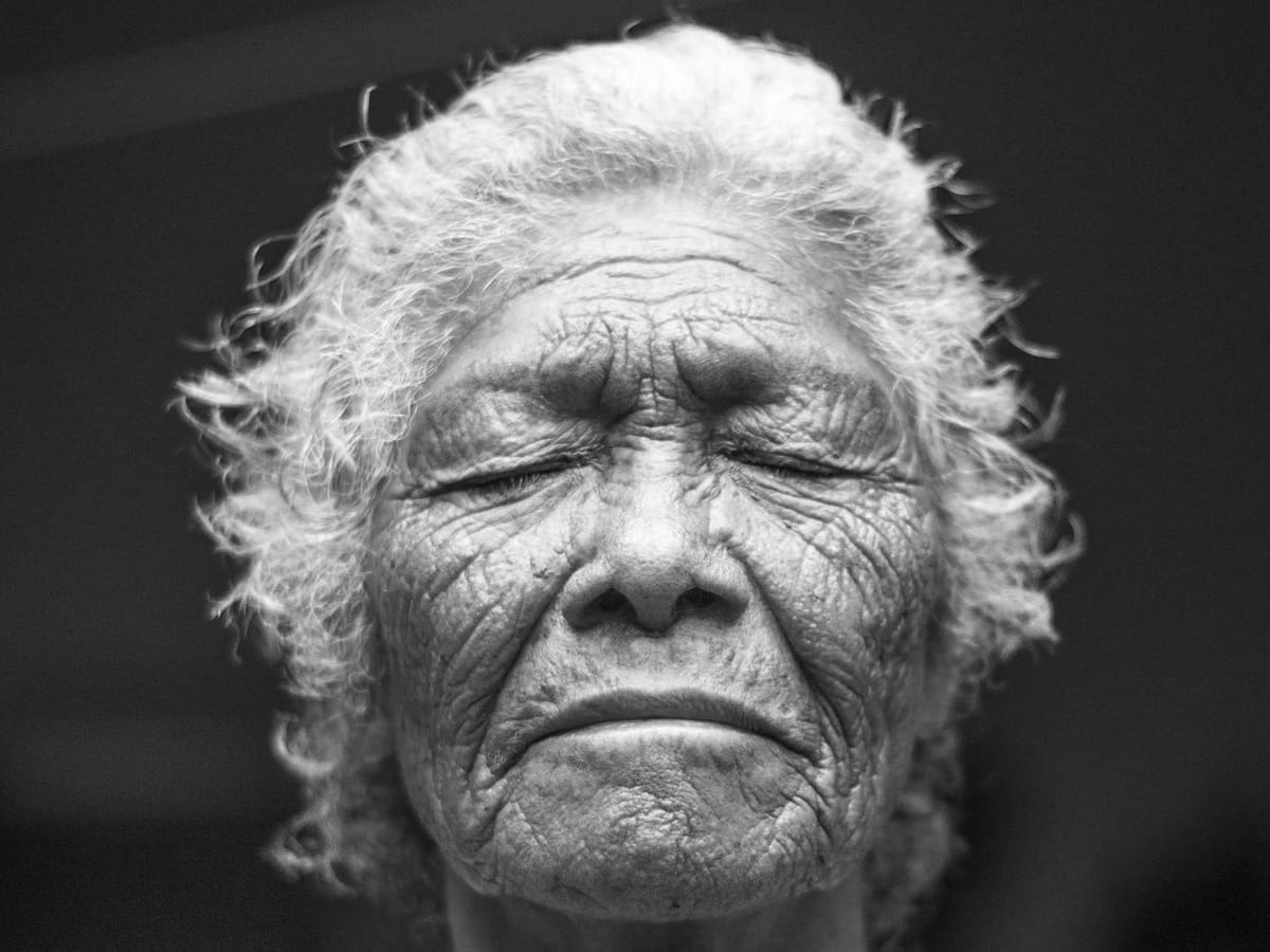 Dementia Stages